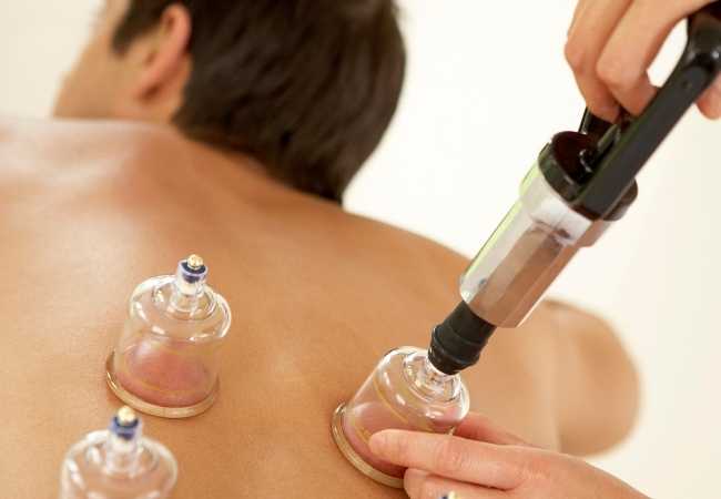Cupping Therapy ​