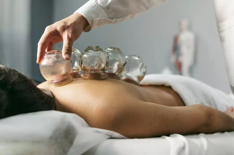 Cupping Therapy Daylesford